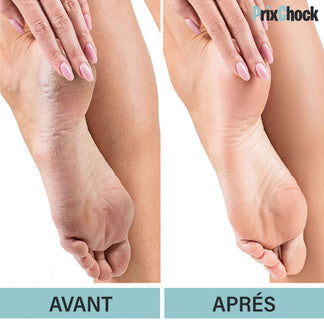 Lime Électrique Professionnelle pour pieds 🎀🧸