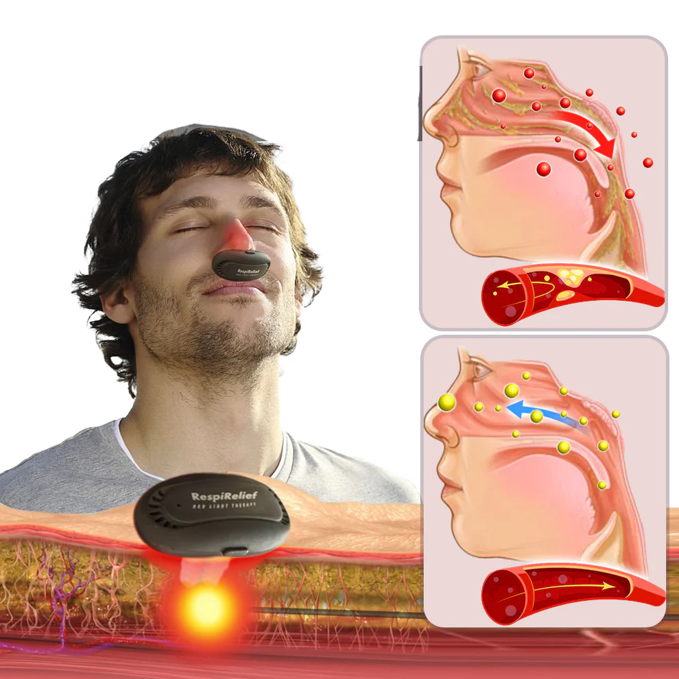 🌟 RespiRelief – Libérez votre respiration avec la thérapie nasale à lumière rouge ! 🌟